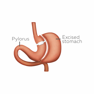 About Asian Bariatrics