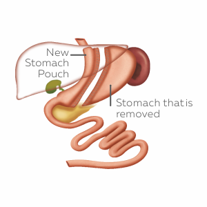 About Asian Bariatrics