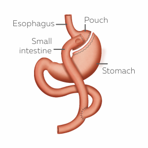 About Asian Bariatrics