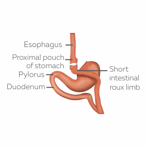 About Asian Bariatrics