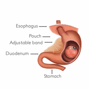 About Asian Bariatrics