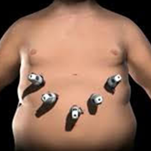 About Asian Bariatrics