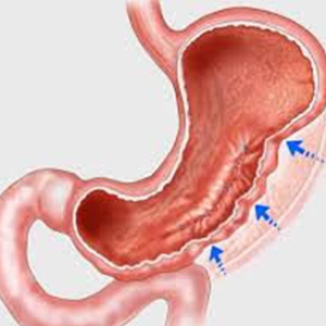 About Asian Bariatrics